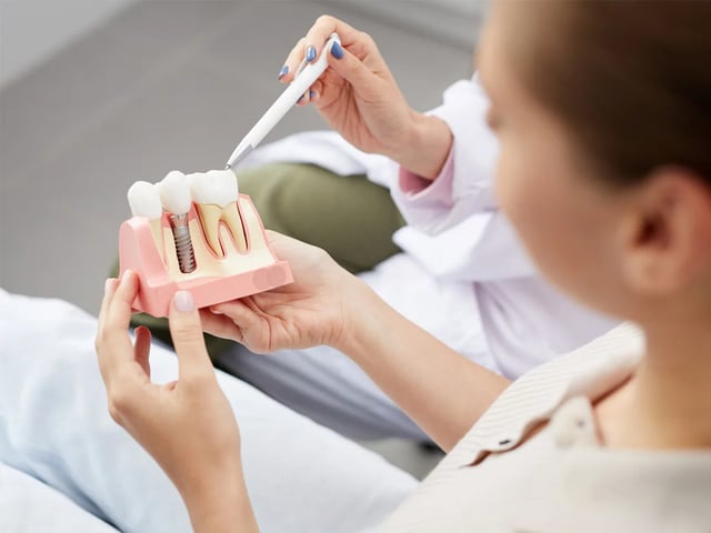 Dental Implants: How They Fuse with Your Jaw Bone