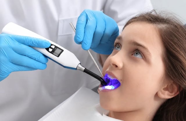 Dental Sealants