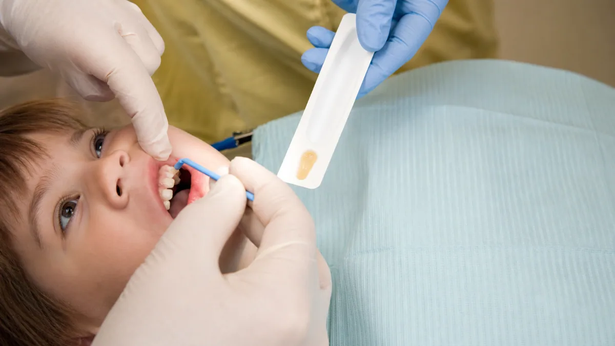 Fluoride Treatment Procedure in North York | Professional Varnish Application for Kids Step-by-step fluoride treatment procedure in North York showing a child receiving professional fluoride varnish application on primary teeth with a dental applicator brush by a hygienist.