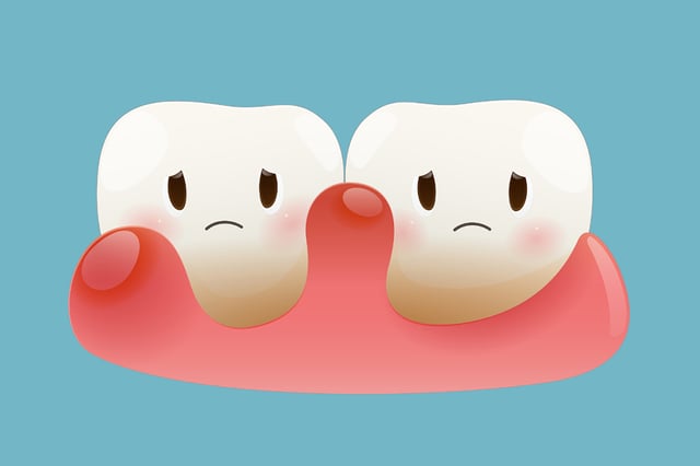 Dentist on Avenue Rd: Advanced Periodontal Therapy
