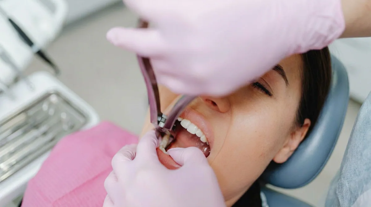 Wisdom Tooth Extraction Procedure in North York | North Toronto Dental Centre A dental professional performing wisdom tooth extraction with specialized instruments in a North York dental clinic