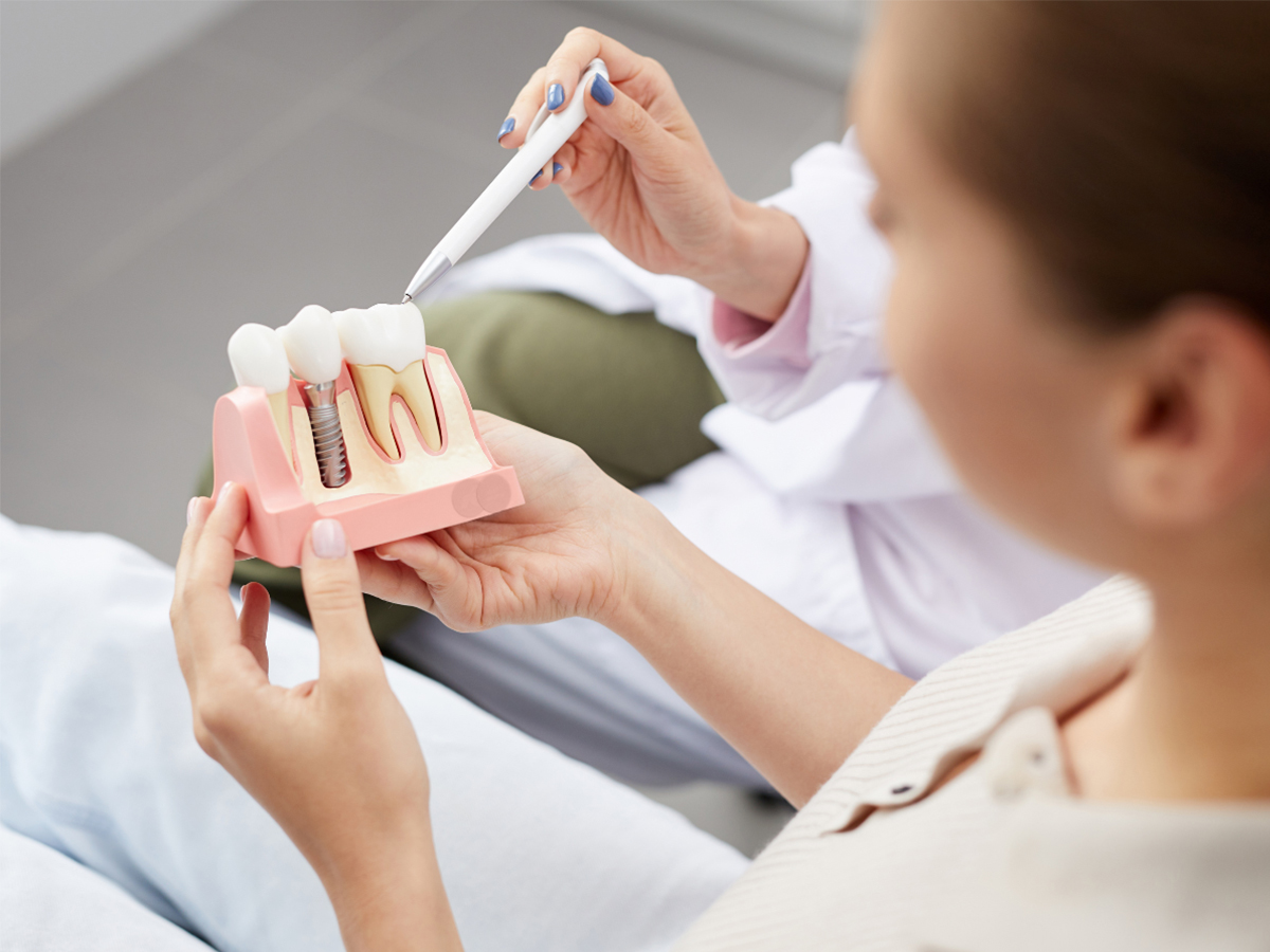 Dental Implants: How They Fuse with Your Jaw Bone